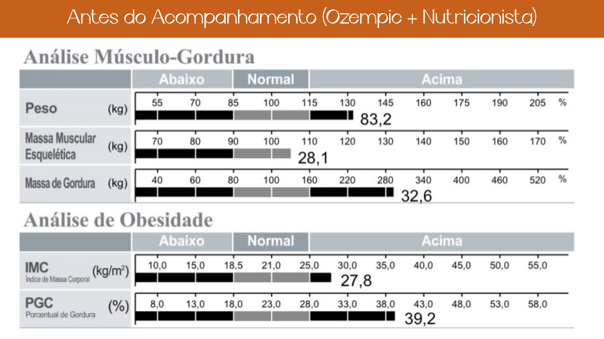 Nutricionista em Brasilia Nutricionista Nutricionista boa Nutricionista bem avaliada Ana Teixeira nutricionista para saúde da mulher nutrição para SOP e endometriose plano alimentar para menopausa recomposição corporal feminina acompanhamento nutricional para lipedema nutricionista especializada em hormônios femininos nutrição individualizada para mulheres caneta emagrecedora e plano alimentar nutricionista especializada em emagrecimento acompanhamento nutricional em Brasília