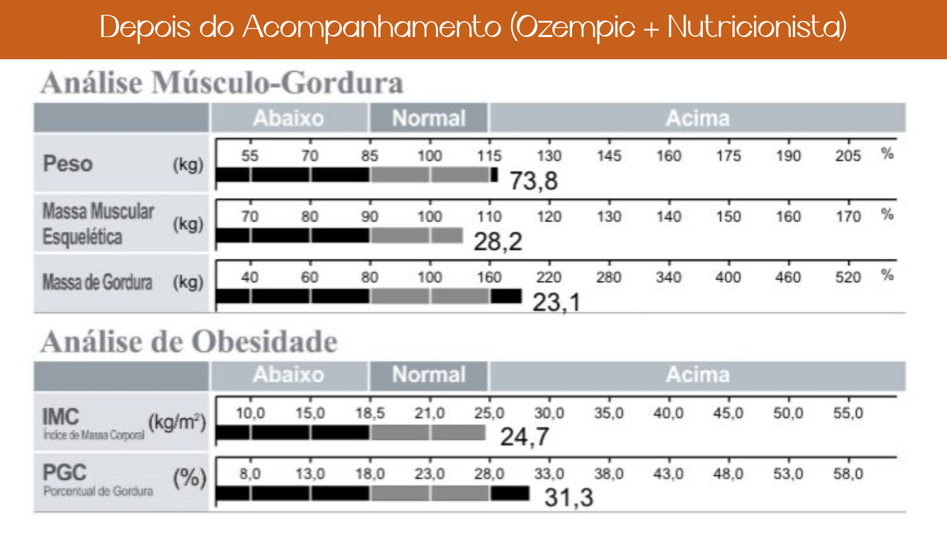 Nutricionista em Brasilia Nutricionista Nutricionista boa Nutricionista bem avaliada Ana Teixeira nutricionista para saúde da mulher nutrição para SOP e endometriose plano alimentar para menopausa recomposição corporal feminina acompanhamento nutricional para lipedema nutricionista especializada em hormônios femininos nutrição individualizada para mulheres caneta emagrecedora e plano alimentar nutricionista especializada em emagrecimento acompanhamento nutricional em Brasília
