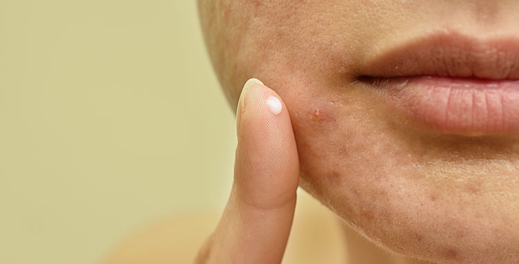 Nutricionista em Brasilia Nutricionista Nutricionista boa Nutricionista bem avaliada Ana Teixeira nutricionista para saúde da mulher nutrição para SOP e endometriose plano alimentar para menopausa recomposição corporal feminina acompanhamento nutricional para lipedema nutricionista especializada em hormônios femininos nutrição individualizada para mulheres caneta emagrecedora e plano alimentar nutricionista especializada em emagrecimento acompanhamento nutricional em Brasília