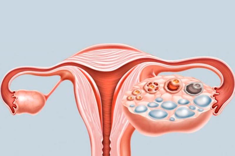 Nutricionista em Brasilia Nutricionista Nutricionista boa Nutricionista bem avaliada Ana Teixeira nutricionista para saúde da mulher nutrição para SOP e endometriose plano alimentar para menopausa recomposição corporal feminina acompanhamento nutricional para lipedema nutricionista especializada em hormônios femininos nutrição individualizada para mulheres caneta emagrecedora e plano alimentar nutricionista especializada em emagrecimento acompanhamento nutricional em Brasília